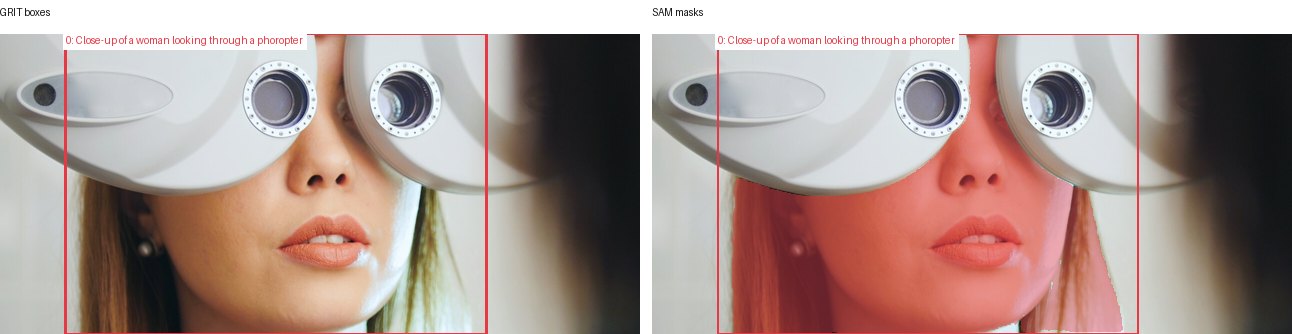 GRIT boxes and SAM masks