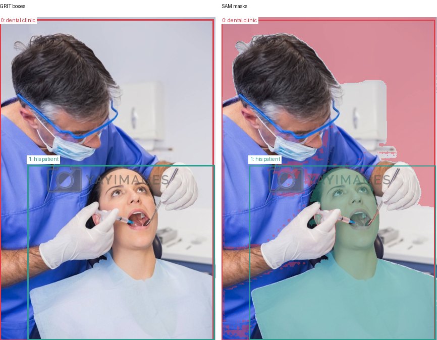 GRIT boxes and SAM masks