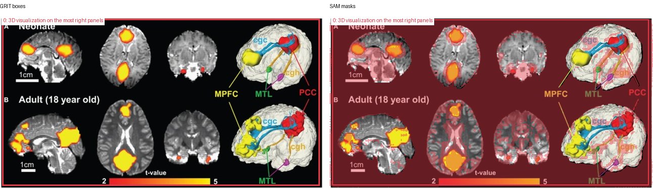 GRIT boxes and SAM masks