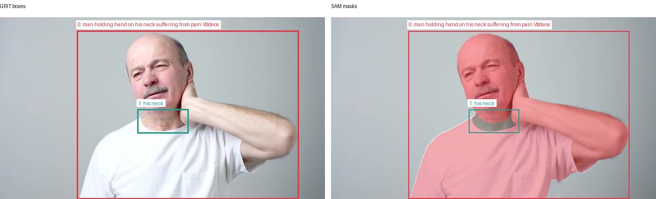 GRIT boxes and SAM masks