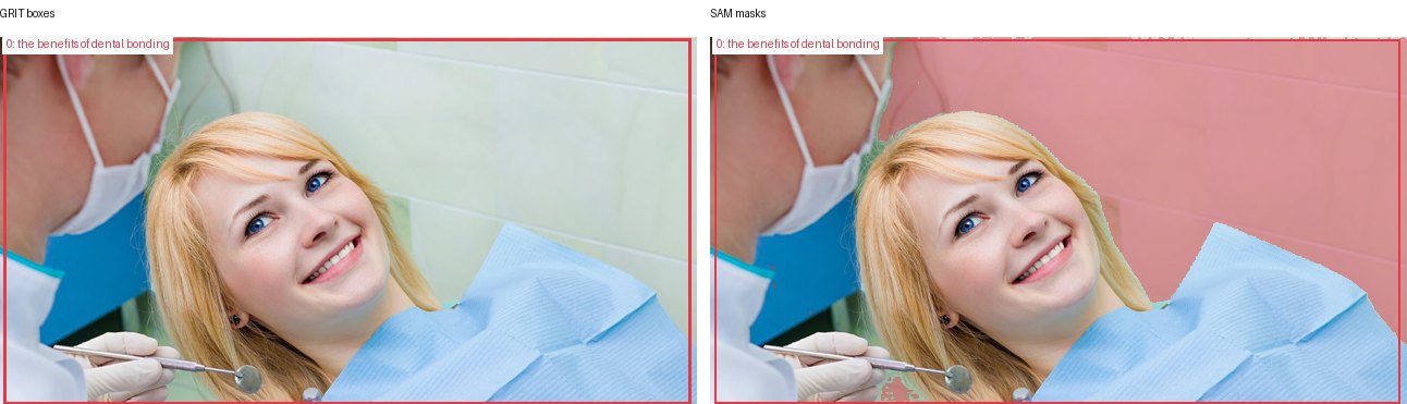 GRIT boxes and SAM masks