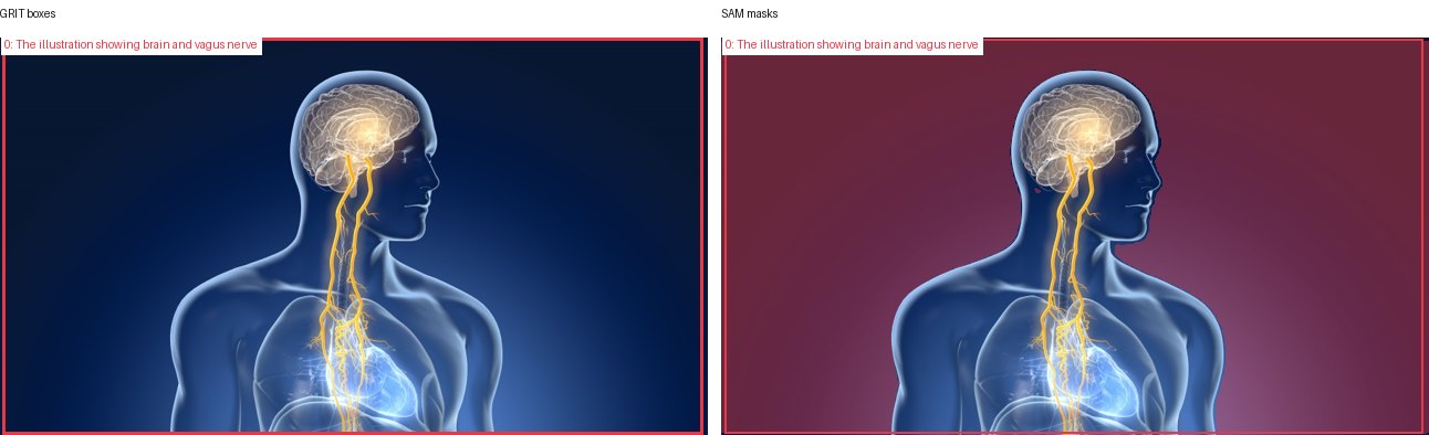 GRIT boxes and SAM masks